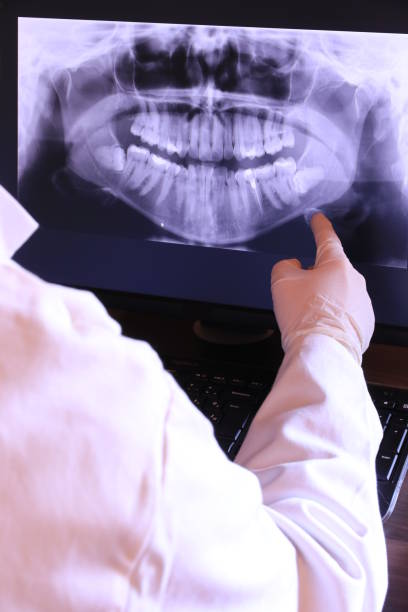 Best Emergency Dental Care for Abscessed Tooth in Bay City, TX